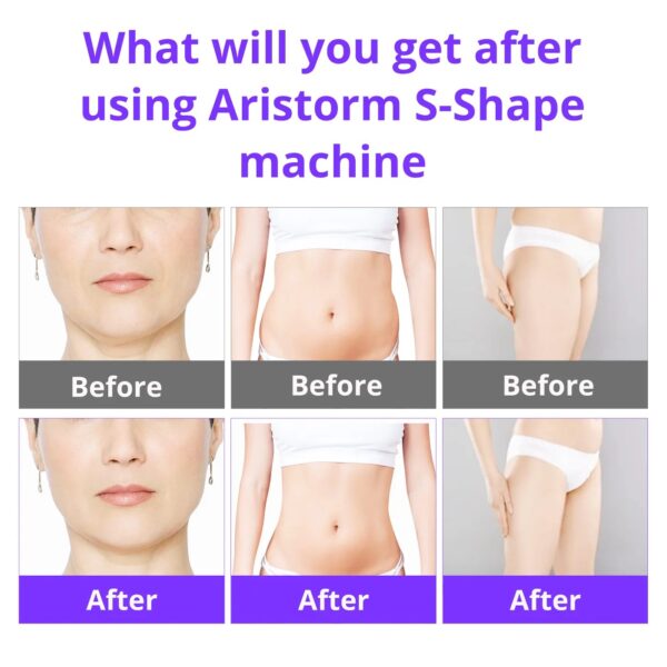 Achieve Your Dream Look with Aristorm S Shape Machine - Image 4