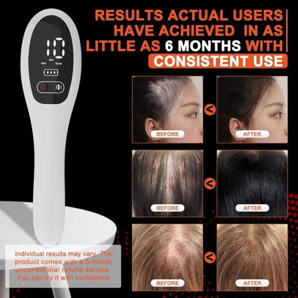 Transform Your Hair with the Electric Laser Hair Growth Comb - Image 4